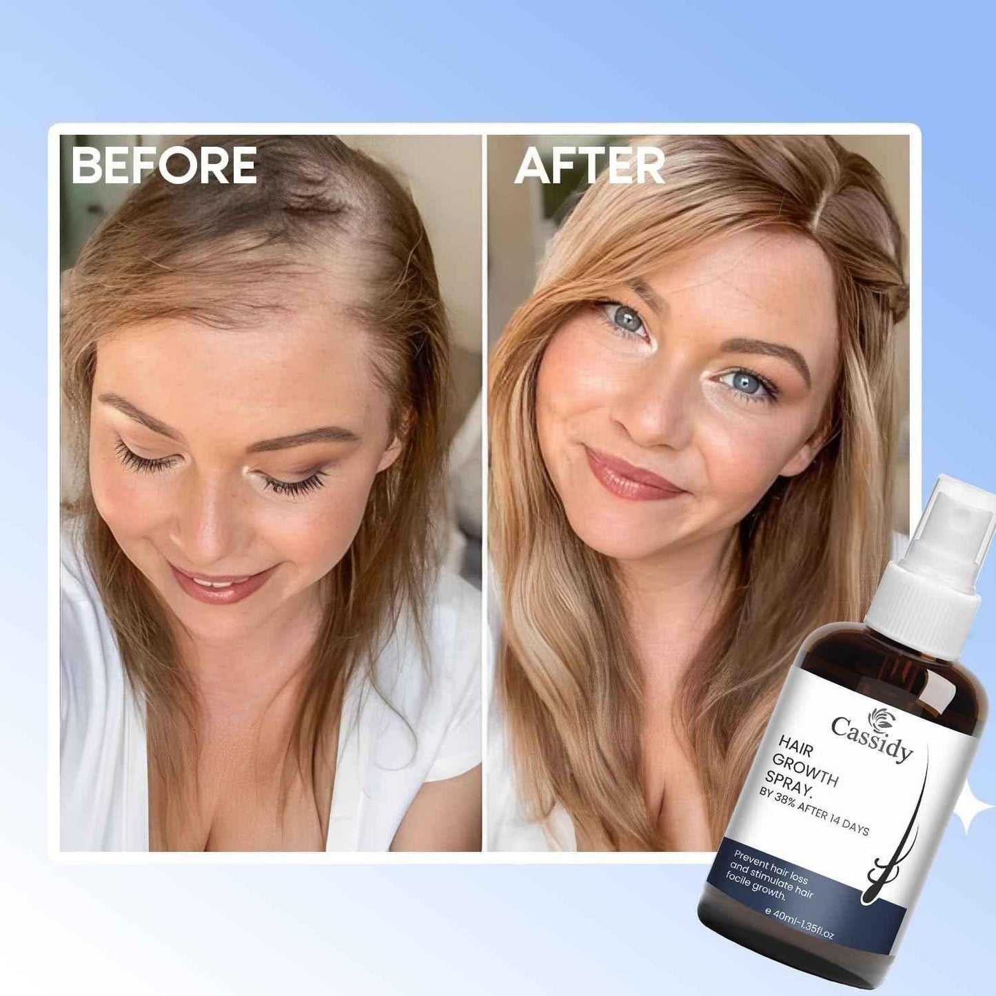 CASSIDY Hair Growth Spray (40ml)