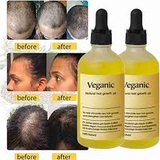 Vegan Natural Hair Growth Oil (Pack of 3)